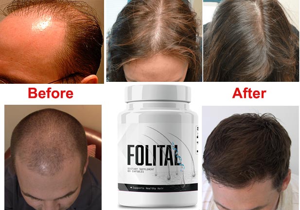 Folital hair regrow